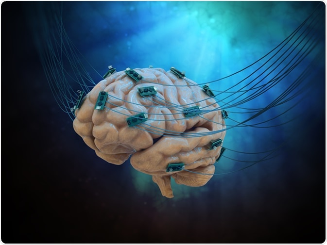 Human brain connected to cables and computer chips. Image Credit: Mopic / Shutterstock